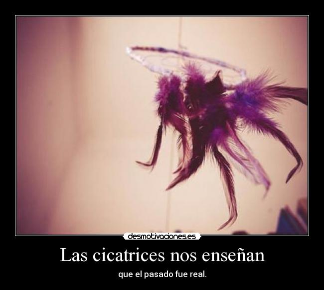 Las cicatrices nos enseñan - que el pasado fue real.