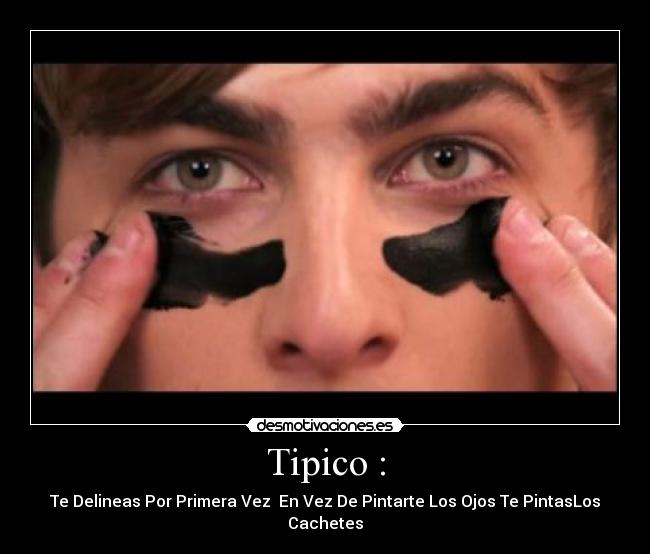 Tipico : -