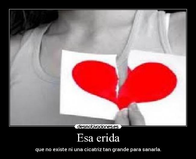 Esa erida - que no existe ni una cicatriz tan grande para sanarla.