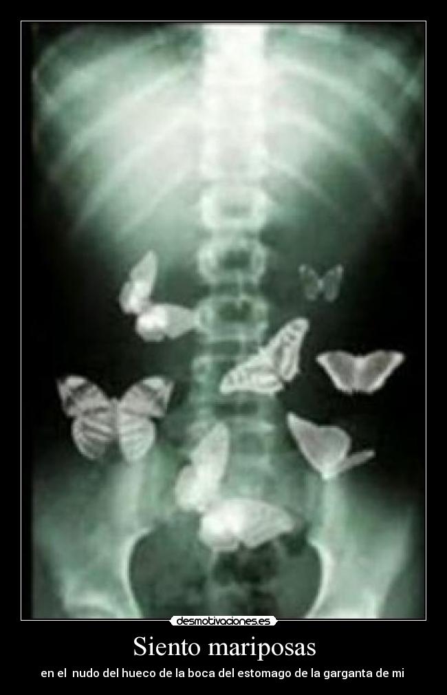 Siento mariposas - 