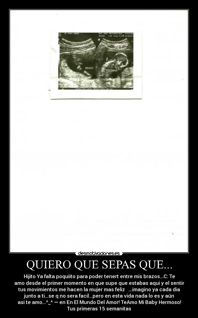 QUIERO QUE SEPAS QUE... - Hijito Ya falta poquiito para poder tenert entre mis brazos...C: Te
amo desde el primer momento en que supe que estabas aqui y el sentir
tus movimientos me hacen la mujer mas feliz ♥ ...imagino ya cada dia
junto a ti...se q no sera facil...pero en esta vida nada lo es y aún
asi te amo...^_^ — en En El Mundo Del Amor! TeAmo Mi Baby Hermoso!
Tus primeras 15 semanitas