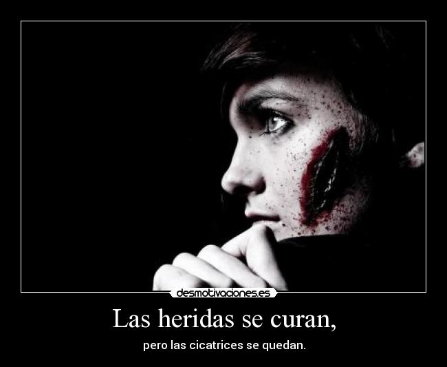 Las heridas se curan, - pero las cicatrices se quedan.