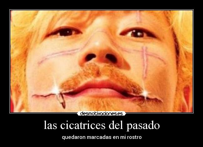 las cicatrices del pasado -