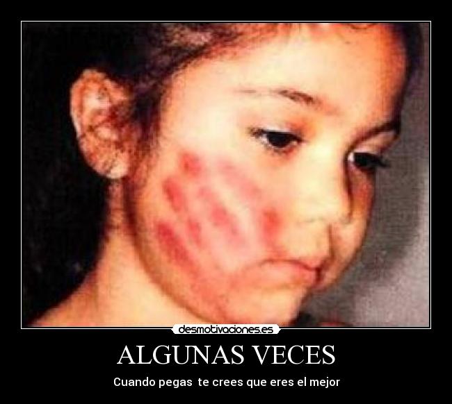ALGUNAS VECES - 