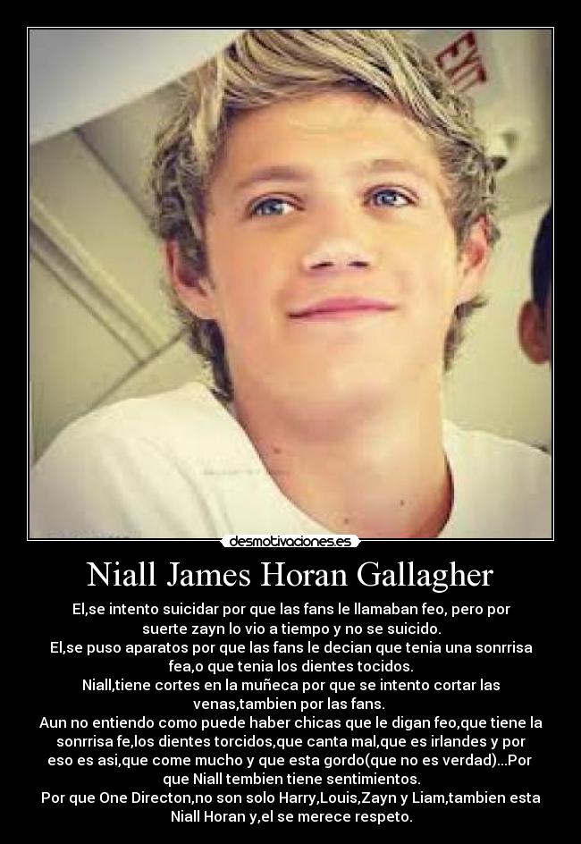 Niall James Horan Gallagher - El,se intento suicidar por que las fans le llamaban feo, pero por
suerte zayn lo vio a tiempo y no se suicido.
El,se puso aparatos por que las fans le decian que tenia una sonrrisa
fea,o que tenia los dientes tocidos.
Niall,tiene cortes en la muñeca por que se intento cortar las
venas,tambien por las fans. 
Aun no entiendo como puede haber chicas que le digan feo,que tiene la
sonrrisa fe,los dientes torcidos,que canta mal,que es irlandes y por
eso es asi,que come mucho y que esta gordo(que no es verdad)...Por 
que Niall tembien tiene sentimientos.
Por que One Directon,no son solo Harry,Louis,Zayn y Liam,tambien esta
Niall Horan y,el se merece respeto.