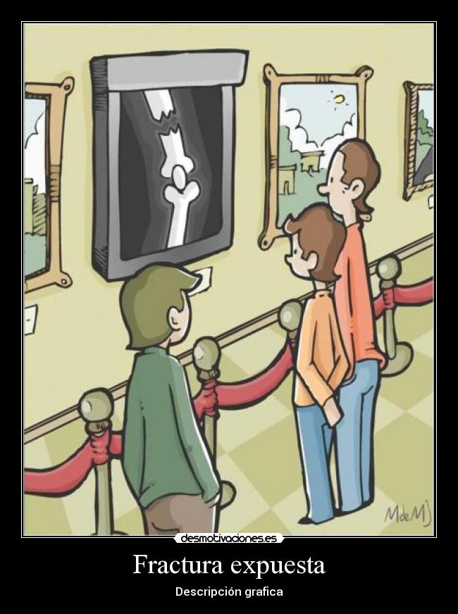 Fractura expuesta -