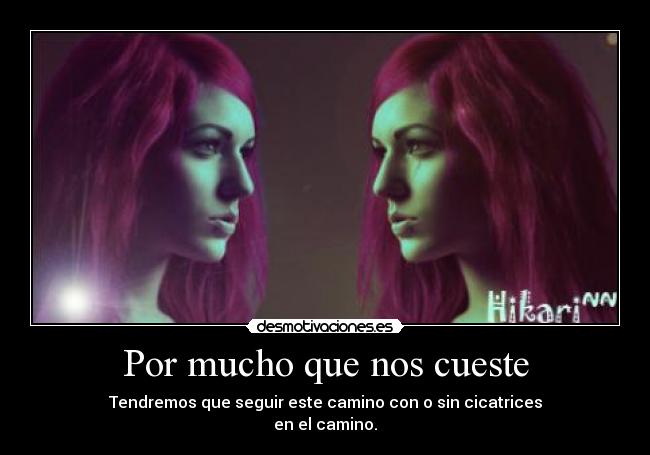 Por mucho que nos cueste - Tendremos que seguir este camino con o sin cicatrices
en el camino.