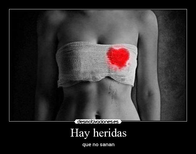 Hay heridas - que no sanan