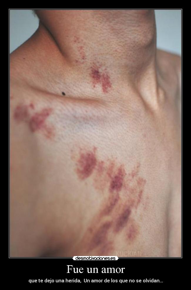 Fue un amor - que te dejo una herida, Un amor de los que no se olvidan...