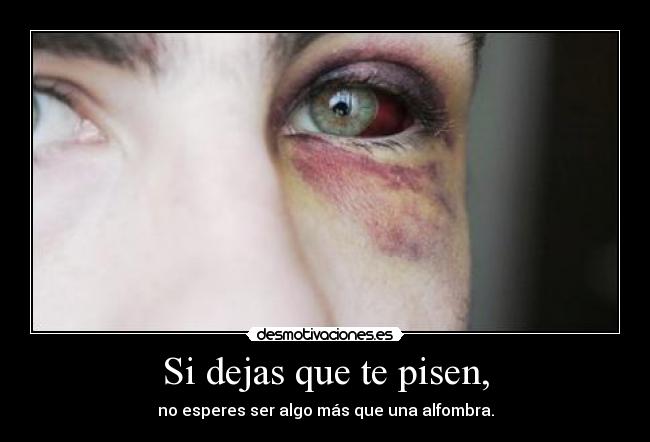 Si dejas que te pisen, - no esperes ser algo más que una alfombra.