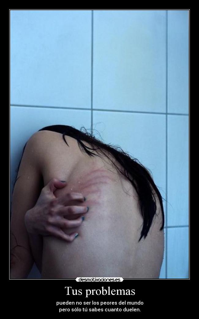 Tus problemas - pueden no ser los peores del mundo
pero sólo tú sabes cuanto duelen.