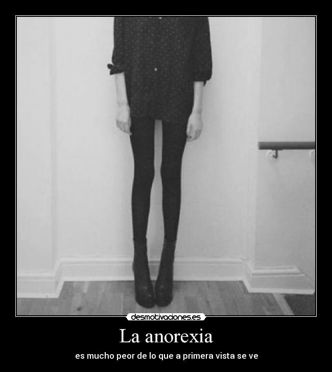 La anorexia - 