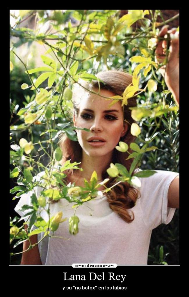 Lana Del Rey - y su no botox en los labios