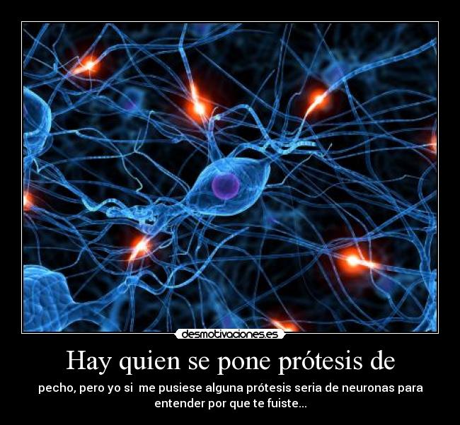 Hay quien se pone prótesis de - pecho, pero yo si me pusiese alguna prótesis seria de neuronas para
entender por que te fuiste...