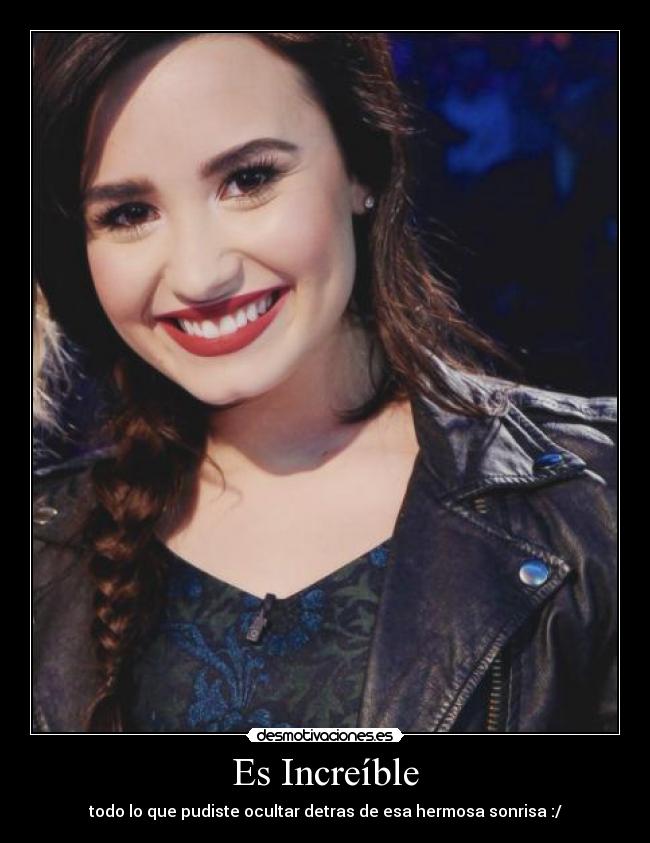Es Increíble - 