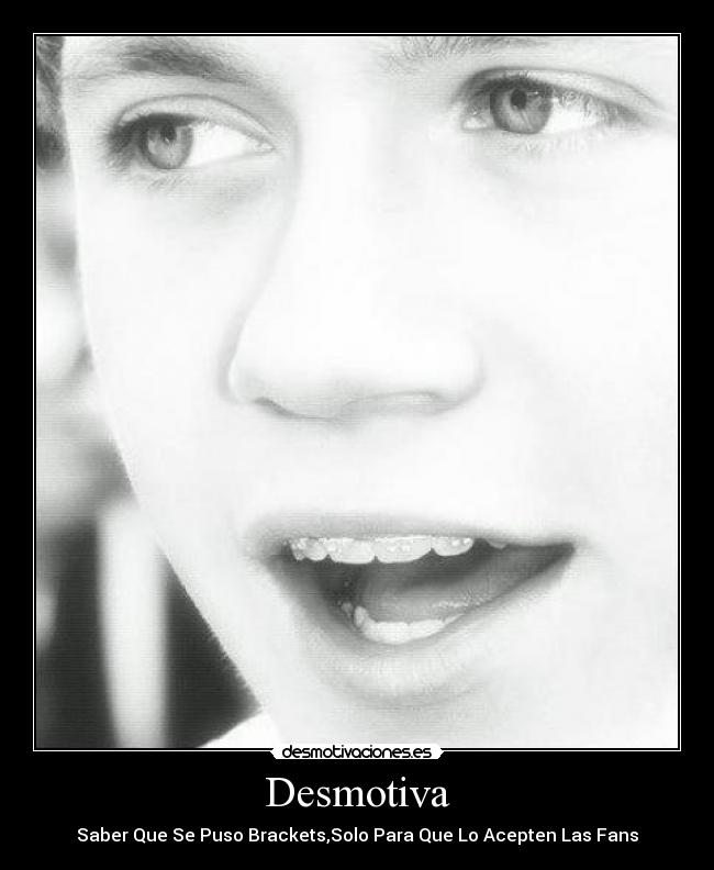 Desmotiva - Saber Que Se Puso Brackets,Solo Para Que Lo Acepten Las Fans