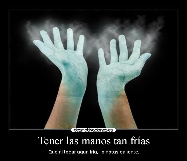 Tener las manos tan frías - Que al tocar agua fría,  lo notas caliente.