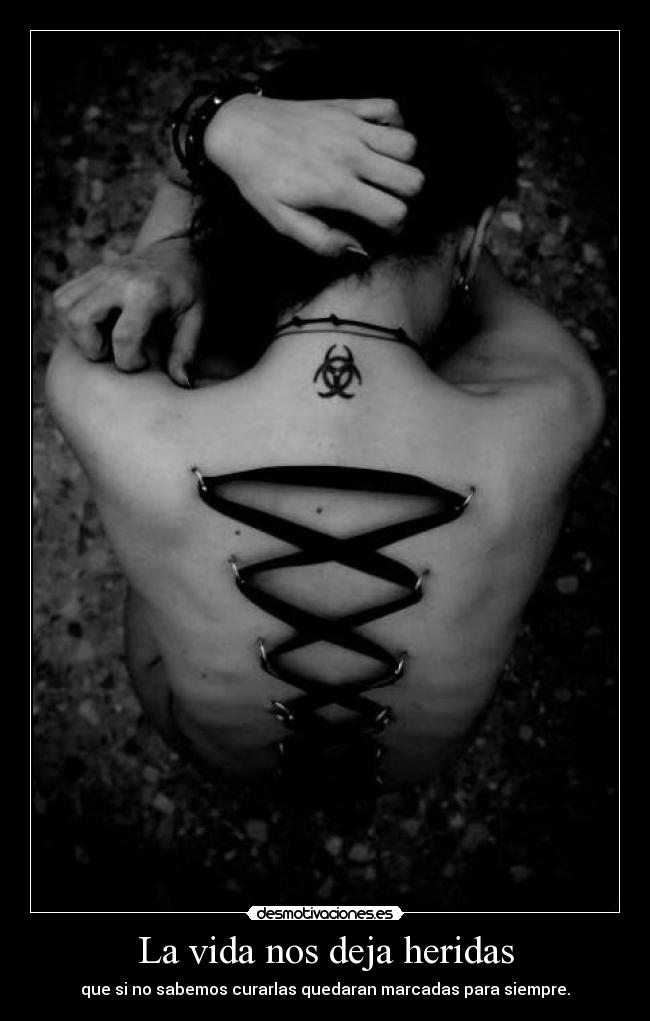 La vida nos deja heridas - que si no sabemos curarlas quedaran marcadas para siempre.