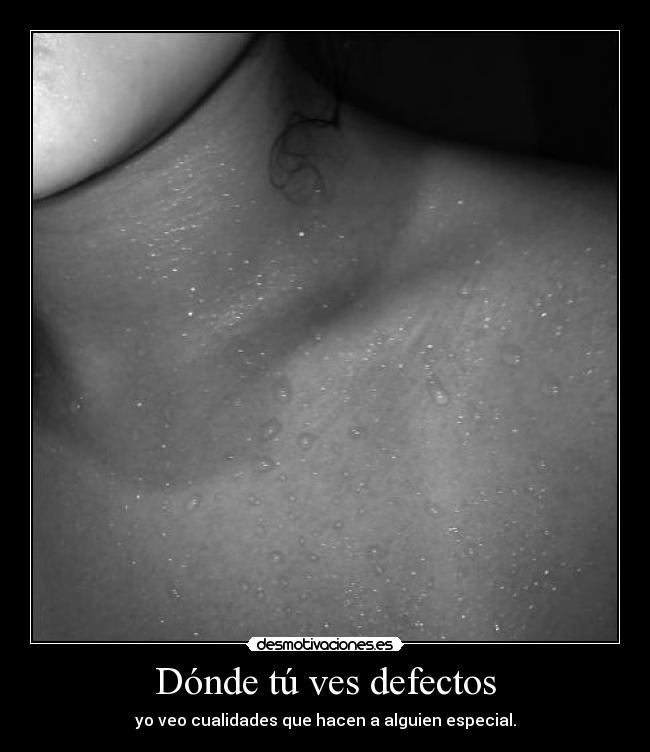 Dónde tú ves defectos - yo veo cualidades que hacen a alguien especial.