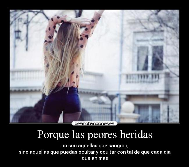 Porque las peores heridas - no son aquellas que sangran,
sino aquellas que puedas ocultar y ocultar con tal de que cada dia duelan mas