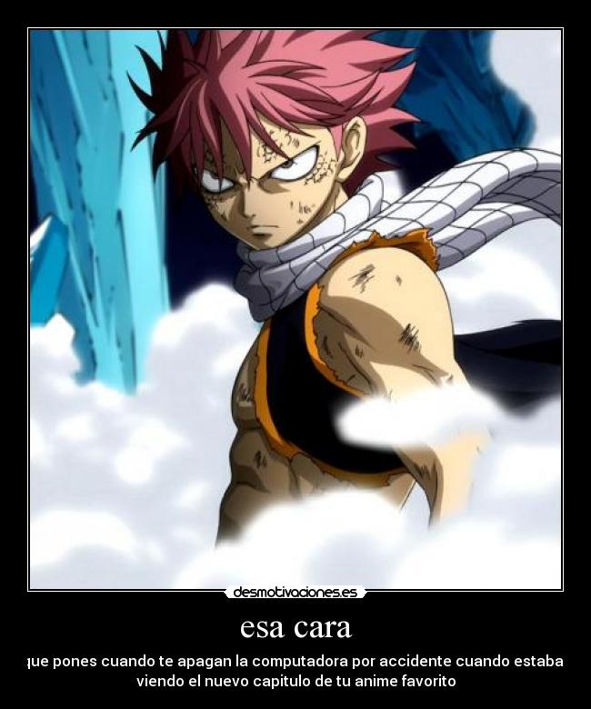 esa cara - que pones cuando te apagan la computadora por accidente cuando estabas
viendo el nuevo capitulo de tu anime favorito