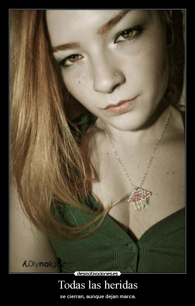 Todas las heridas -