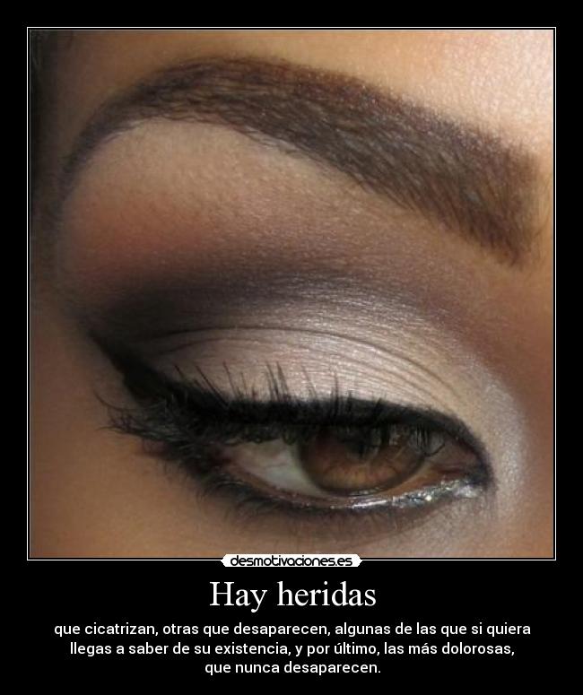 Hay heridas - que cicatrizan, otras que desaparecen, algunas de las que si quiera
llegas a saber de su existencia, y por último, las más dolorosas,
que nunca desaparecen.