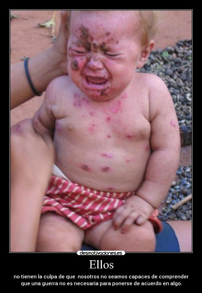Ellos - no tienen la culpa de que nosotros no seamos capaces de comprender
que una guerra no es necesaria para ponerse de acuerdo en algo.