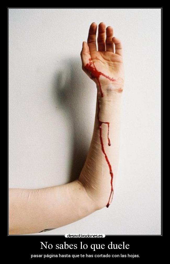 No sabes lo que duele -