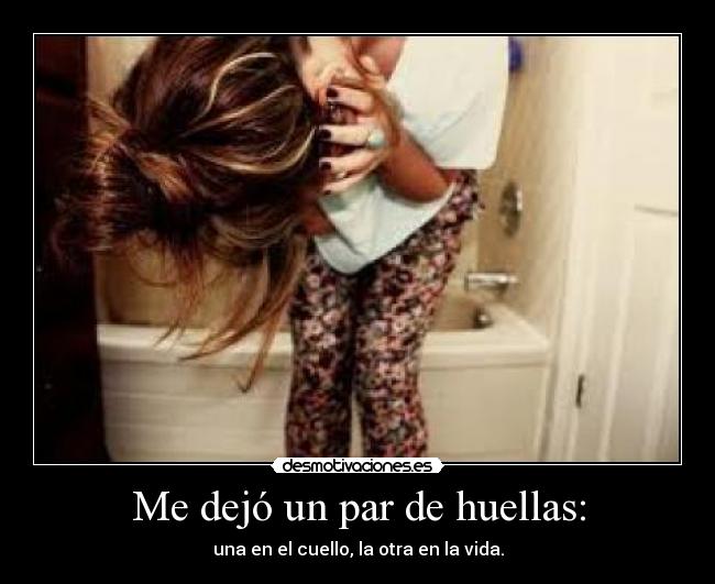 Me dejó un par de huellas: - una en el cuello, la otra en la vida.