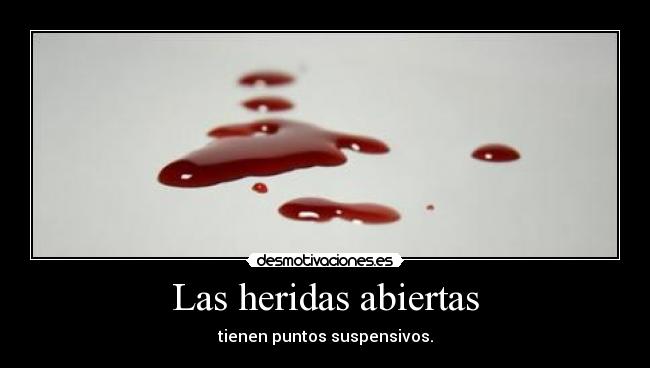 Las heridas abiertas -