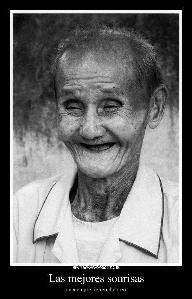 Las mejores sonrisas - no siempre tienen dientes.