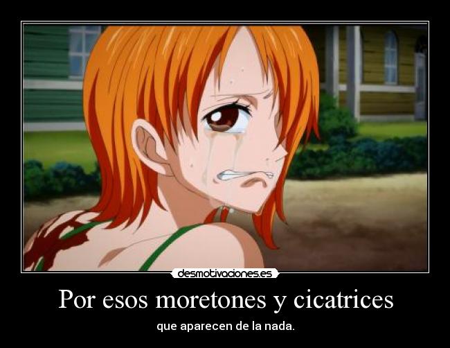 Por esos moretones y cicatrices - 