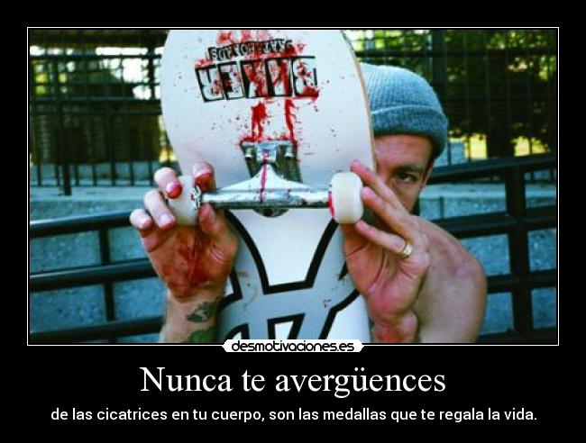 Nunca te avergüences - 