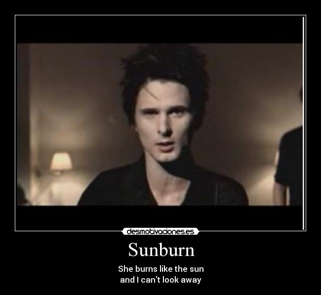 Sunburn - She burns like the sun
and I cant look away♫