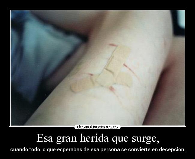 Esa gran herida que surge, - cuando todo lo que esperabas de esa persona se convierte en decepción.