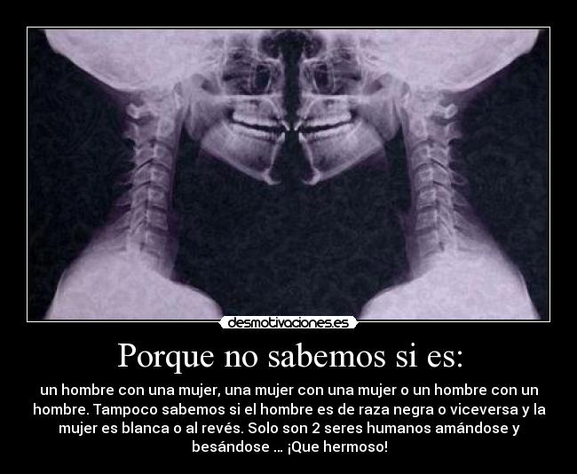 Porque no sabemos si es: - un hombre con una mujer, una mujer con una mujer o un hombre con un
hombre. Tampoco sabemos si el hombre es de raza negra o viceversa y la
mujer es blanca o al revés. Solo son 2 seres humanos amándose y
besándose … ¡Que hermoso!