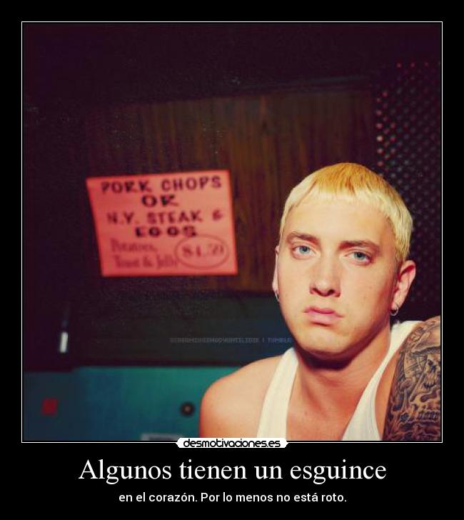 Algunos tienen un esguince - en el corazón. Por lo menos no está roto.