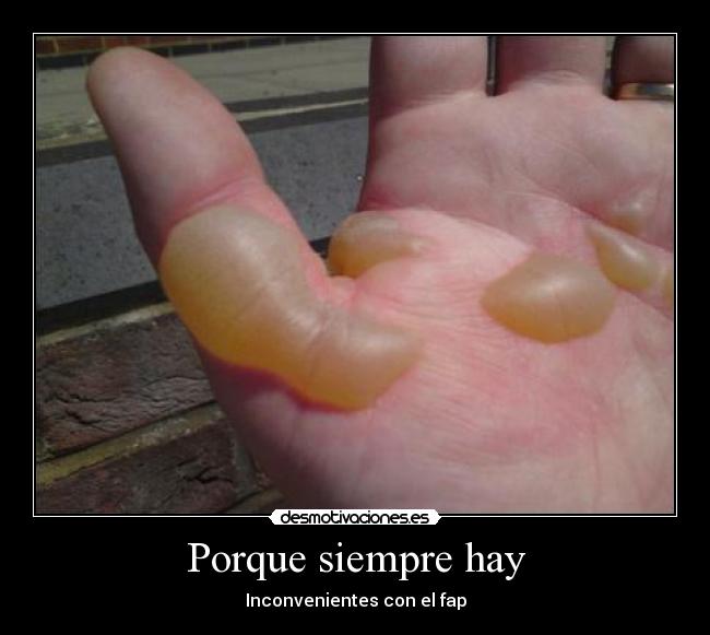 Porque siempre hay - Inconvenientes con el fap