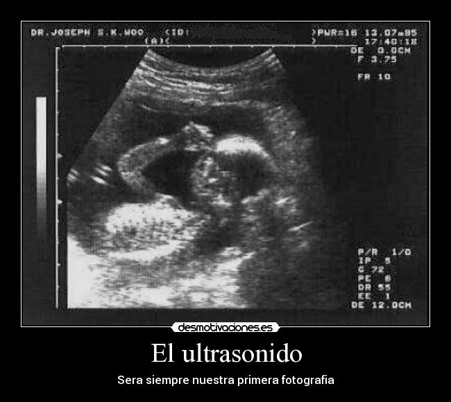 carteles ultrasonido desmotivaciones