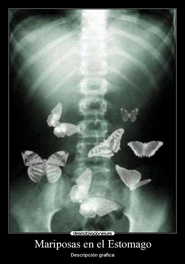 Mariposas en el Estomago -