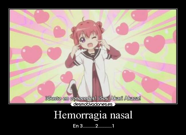 Hemorragia nasal - En 3...........2............1