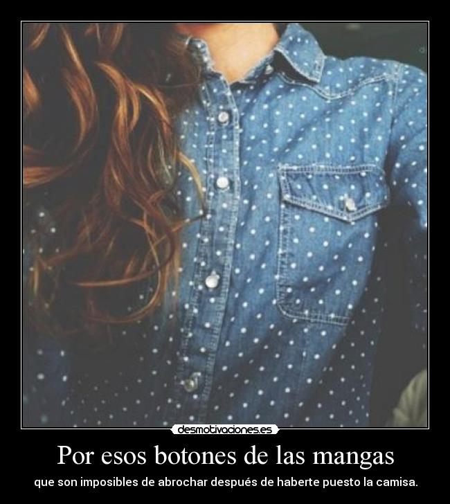 Por esos botones de las mangas -