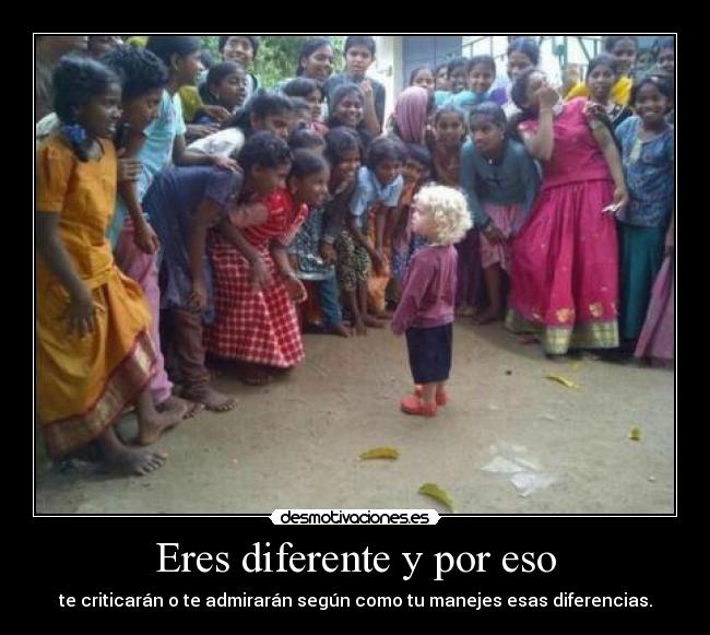Eres diferente y por eso -