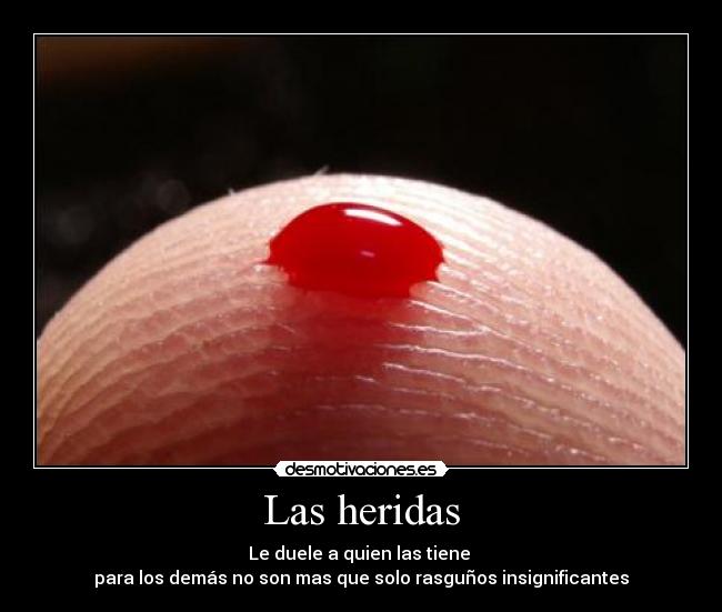 Las heridas - 
