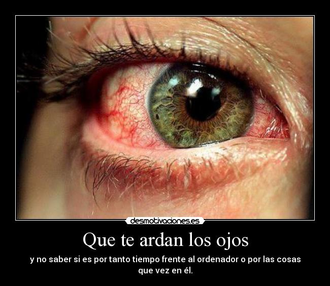 Que te ardan los ojos -