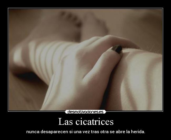Las cicatrices - 