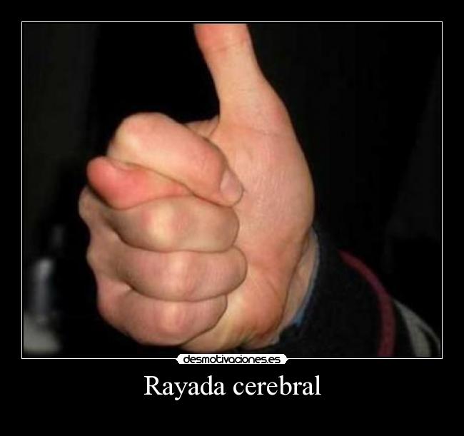Rayada cerebral -