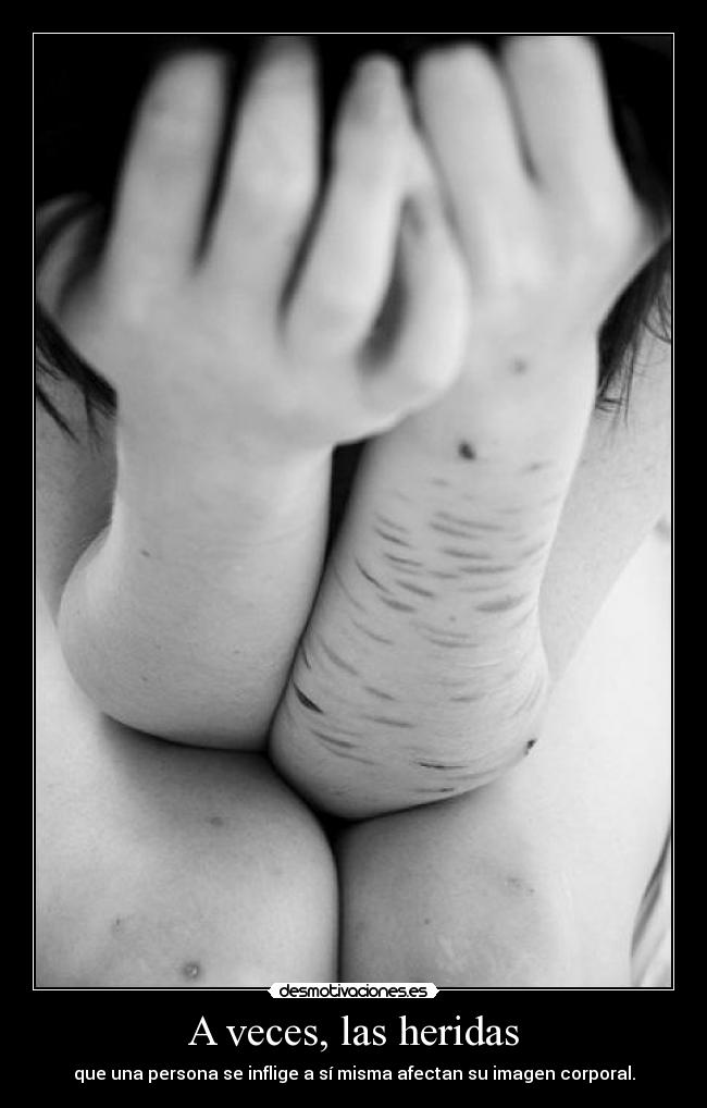 A veces, las heridas - que una persona se inflige a sí misma afectan su imagen corporal.