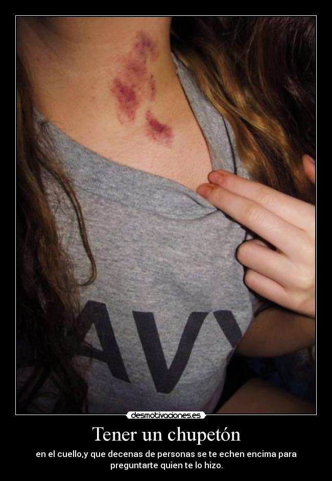 Tener un chupetón - en el cuello,y que decenas de personas se te echen encima para
preguntarte quien te lo hizo.